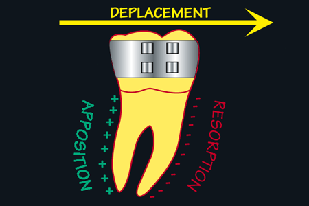 Réactions osseuses aux forces orthodontiques et déplacement dentaire